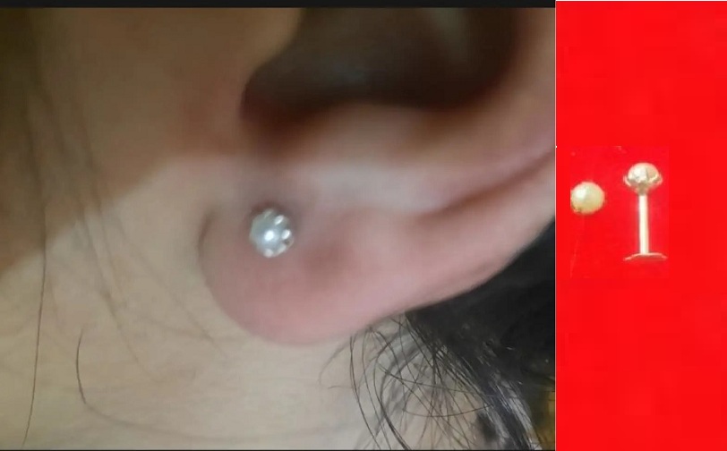 Ear tops